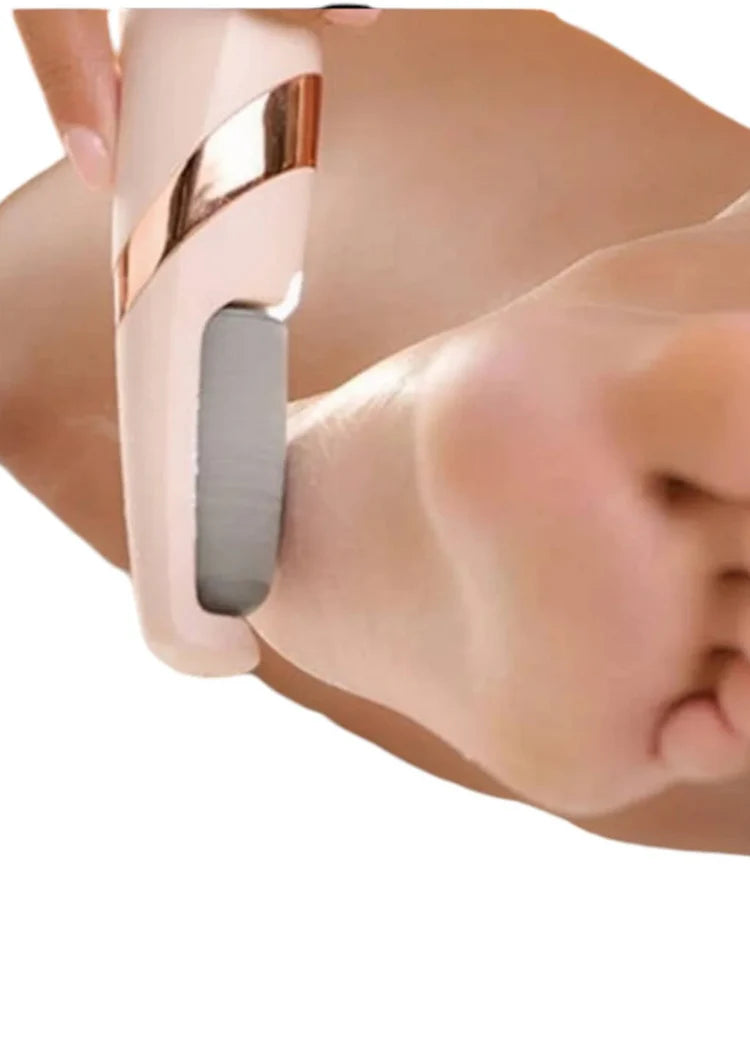 Removedor de callos ¡Tu pedicure profesional en casa!