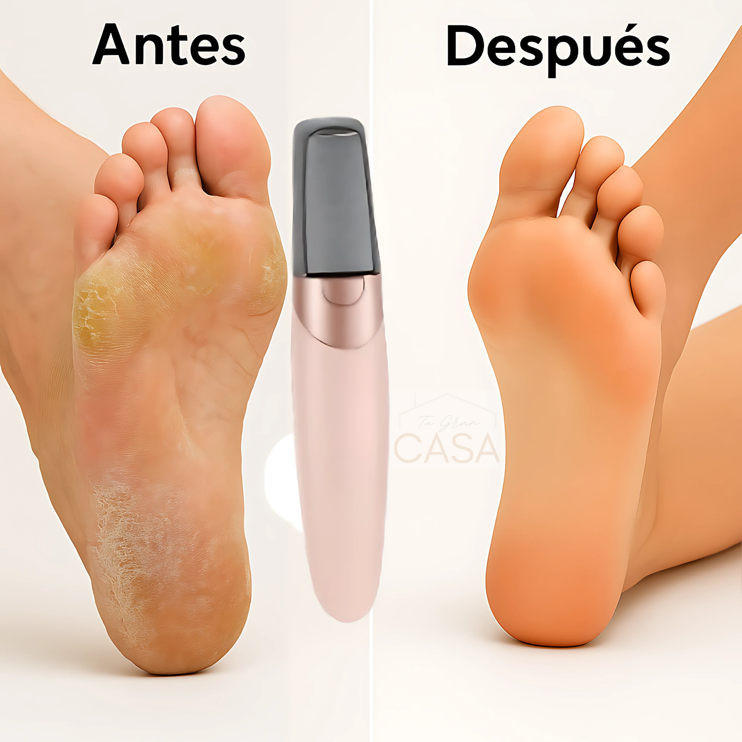 Removedor de callos ¡Tu pedicure profesional en casa!